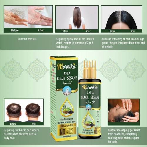 MORVIKA Amla Black Sesame Hair Oil For Hair Fall Control and Hair Growth - Comb Applicator Bottle for Men & Women 100 Ml