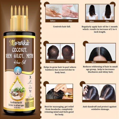 MORVIKA Herbal Coconut Neem Giloy, Methi (Fenugreek) Hair Oil For Men And Women Hair Oil  (100 ml)